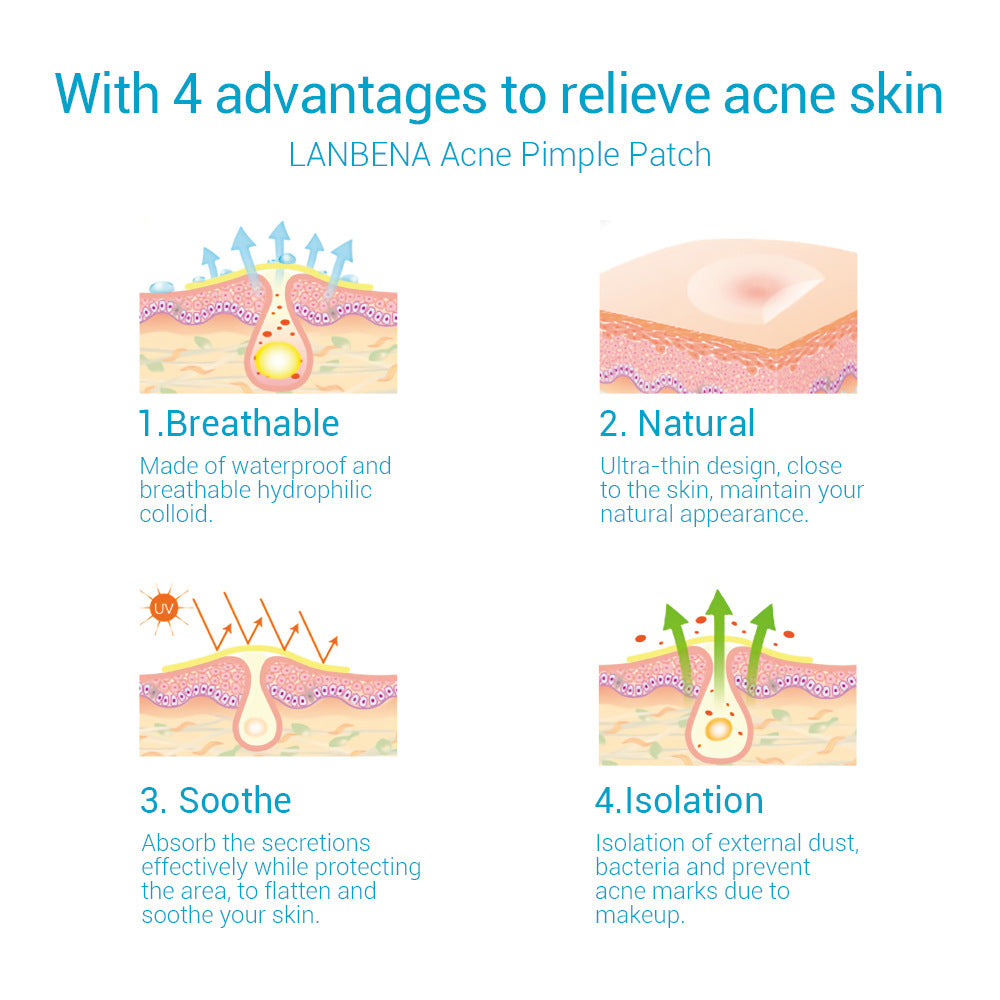 Infographic of four pimple patch benefits: breathable, natural, soothing and protective