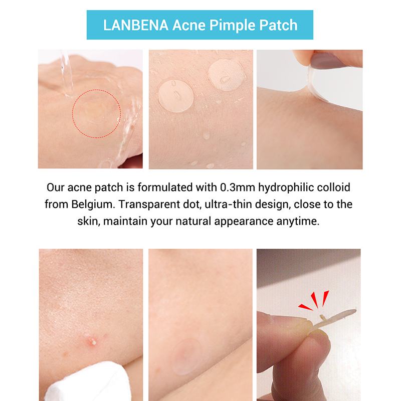 Ultra-thin 0.3mm invisible hydrocolloid pimple patch applied on skin
